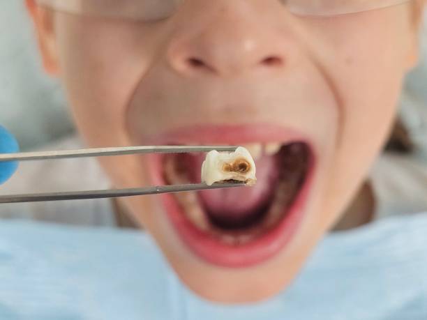 Best Pediatric Emergency Dentist in Baird, TX