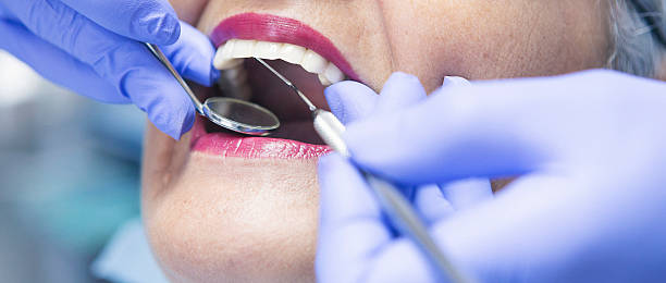 Best Emergency Tooth Extraction in Baird, TX